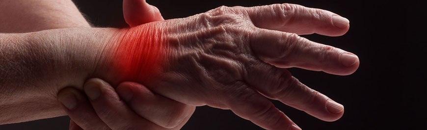 What is Arthritis